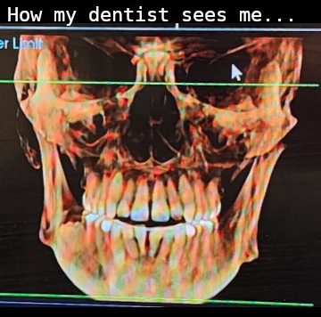 How my dentist sees me.